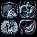 КТ печінки селезінки підшлункової залози шлунку