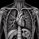 КТ грудної клітки